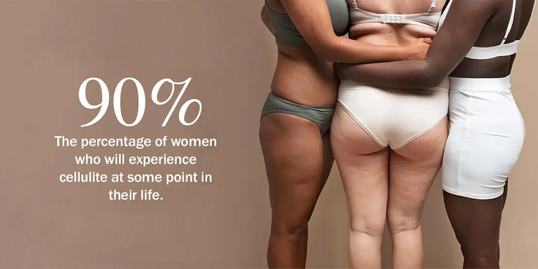 90-of-Women-Have-Cellulite-And-It-Has-Nothing-to-Do-With-Being-Fat DrBioCare
